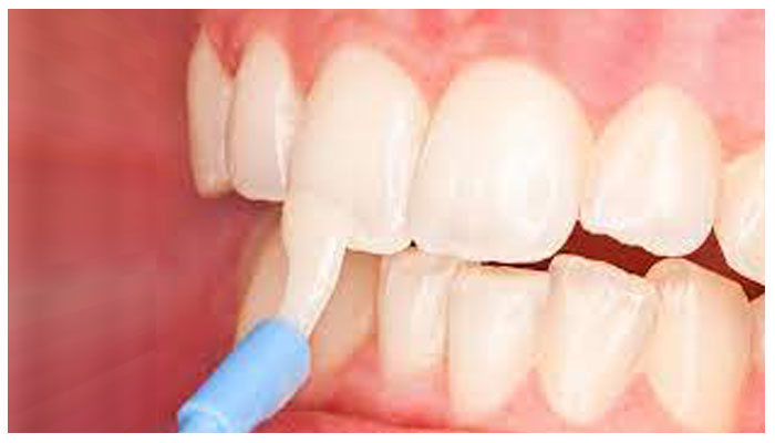 pediatric dentist in Abu Dhabi